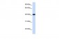 GTF2B antibody - N-terminal region